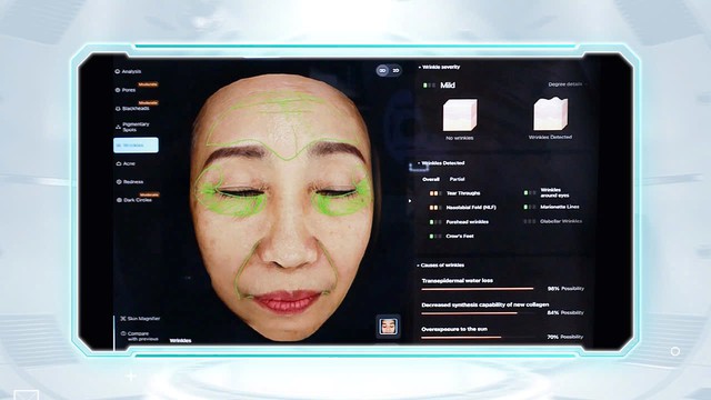 Cùng bác sĩ Nguyễn Hồng Quân 'chỉ mặt điểm tên' 3 xu hướng trẻ hóa lên ngôi 2025- Ảnh 3. Cùng bác sĩ Nguyễn Hồng Quân 'chỉ mặt điểm tên' 3 xu hướng trẻ hóa lên ngôi 2025- Ảnh 3.