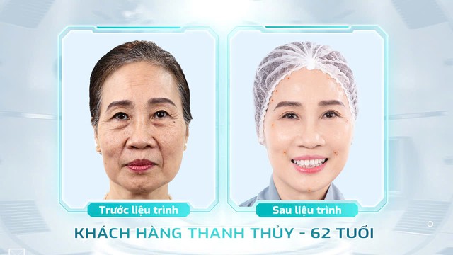 Cùng bác sĩ Nguyễn Hồng Quân 'chỉ mặt điểm tên' 3 xu hướng trẻ hóa lên ngôi 2025- Ảnh 4. Cùng bác sĩ Nguyễn Hồng Quân 'chỉ mặt điểm tên' 3 xu hướng trẻ hóa lên ngôi 2025- Ảnh 4.