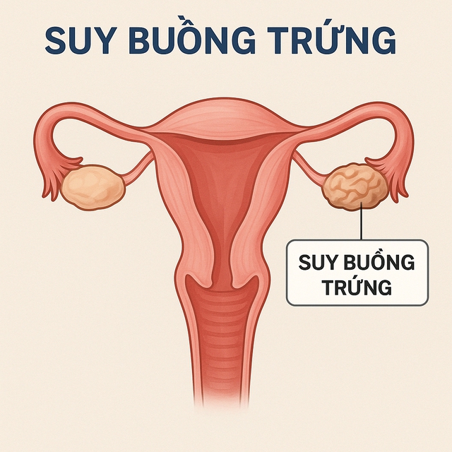 Suy buồng trứng là tình trạng chức năng của buồng trứng ngừng hoạt động và ngừng sản xuất trứng. Suy buồng trứng khiến việc sản xuất các hormone như estrogen và progesterone bị ngừng lại. Suy buồng trứng là tình trạng chức năng của buồng trứng ngừng hoạt động và ngừng sản xuất trứng. Suy buồng trứng khiến việc sản xuất các hormone như estrogen và progesterone bị ngừng lại.