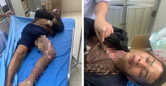 Leo trạm biến áp cắt trộm dây điện, hai người bị điện giật bỏng nặng- Ảnh 1. Leo trạm biến áp cắt trộm dây điện, hai người bị điện giật bỏng nặng- Ảnh 1.
