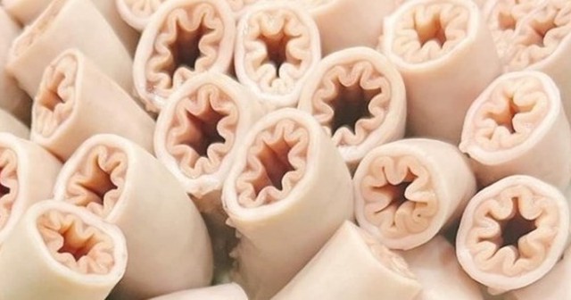 Chuyên gia: Con lợn nào có nhiều giun sán thì khả năng có lòng se điếu- Ảnh 2. Chuyên gia: Con lợn nào có nhiều giun sán thì khả năng có lòng se điếu- Ảnh 2.