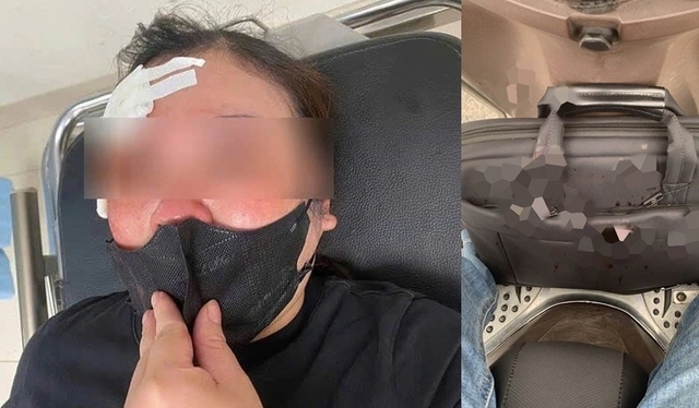 Một phụ nữ bị đánh giữa phố vì dừng xe nghe điện thoại- Ảnh 2. Một phụ nữ bị đánh giữa phố vì dừng xe nghe điện thoại- Ảnh 2.