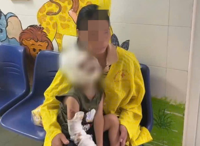 Dùng xăng để đốt kiến, hai anh em bỏng nặng- Ảnh 2. Dùng xăng để đốt kiến, hai anh em bỏng nặng- Ảnh 2.