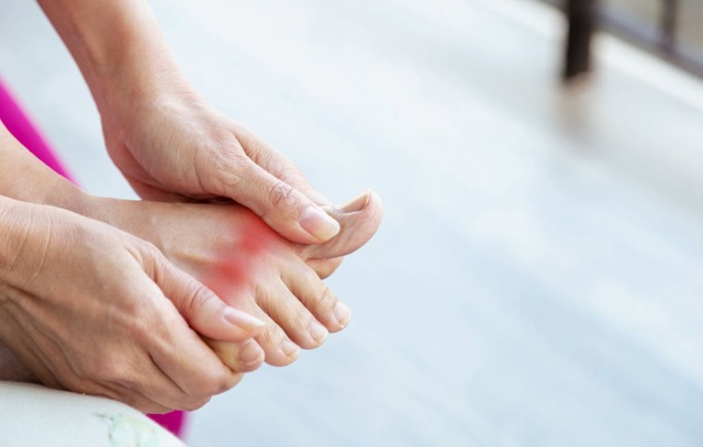 Lý do nam giới mắc gout cao gấp 10 lần nữ giới- Ảnh 1. Lý do nam giới mắc gout cao gấp 10 lần nữ giới- Ảnh 1.