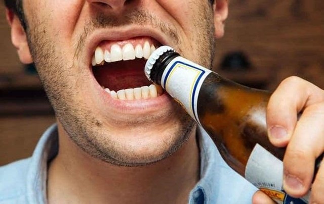 Nói không với thói quen xấu, bảo vệ sức khỏe răng miệng- Ảnh 2.