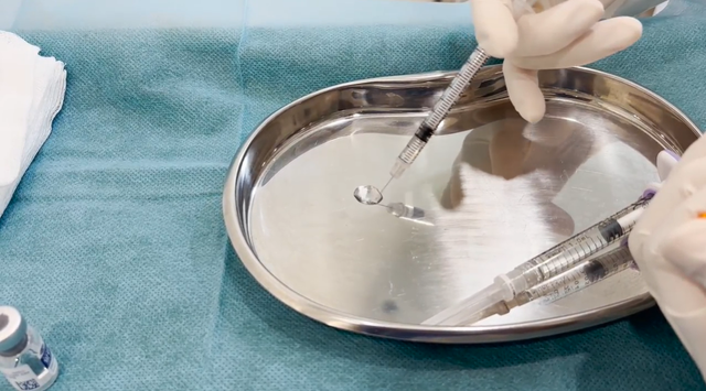 Filler bán tràn lan trên MXH, cách nào để nhận biết thật giả?- Ảnh 3. Filler bán tràn lan trên MXH, cách nào để nhận biết thật giả?- Ảnh 3.