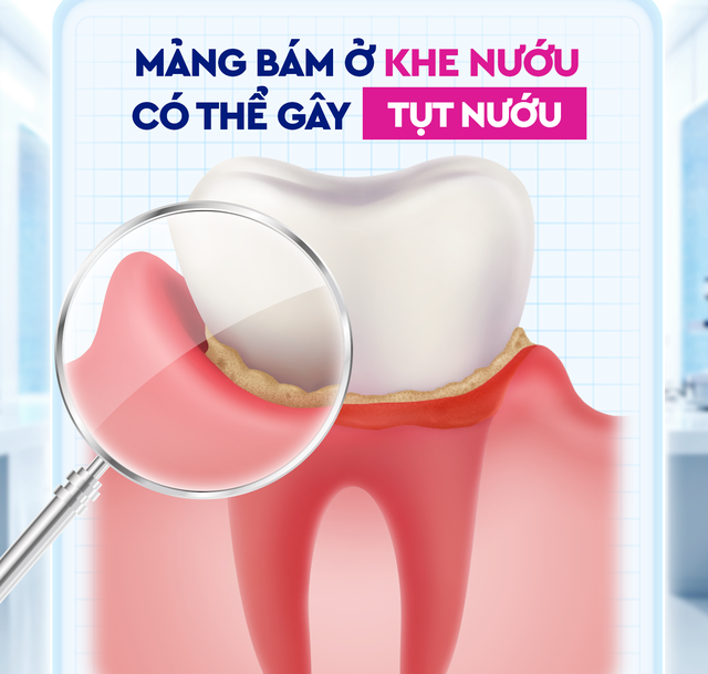 Đánh răng sau khi ăn: Liệu có cần thiết?- Ảnh 1. Đánh răng sau khi ăn: Liệu có cần thiết?- Ảnh 1.