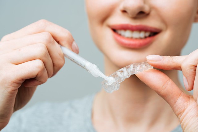 Tẩy trắng răng bằng baking soda và chanh có làm hại men răng không? - Ảnh 2. Tẩy trắng răng bằng baking soda và chanh có làm hại men răng không? - Ảnh 2.