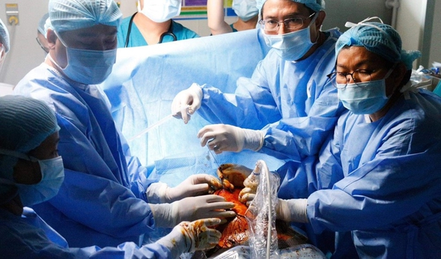 Hành trình ít người biết về kỳ tích can thiệp tim bào thai ở Việt Nam- Ảnh 5. Hành trình ít người biết về kỳ tích can thiệp tim bào thai ở Việt Nam- Ảnh 5.
