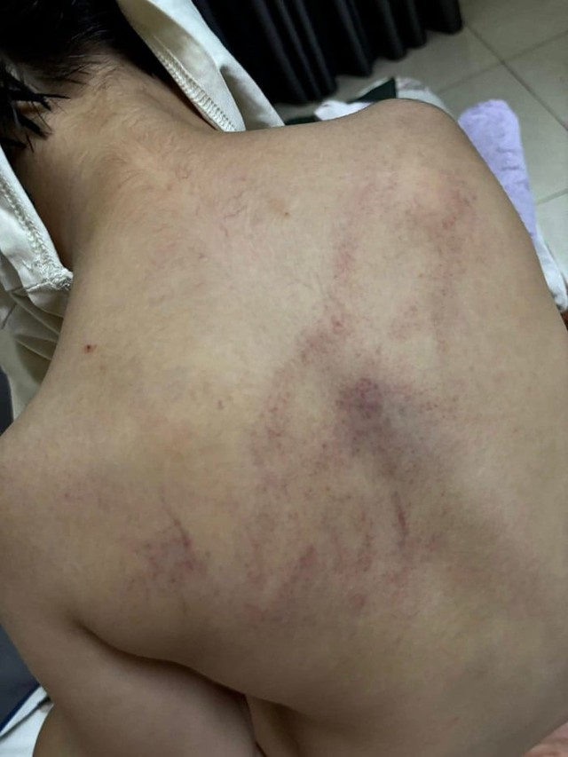 Vụ bạo hành trẻ ở Trường Mầm non Gia Thụy: 2 giáo viên bị tạm đình chỉ- Ảnh 1.
