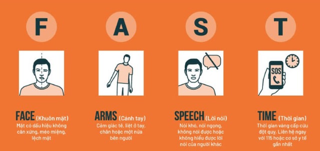Nhận biết sớm đột quỵ và ngừng tim để cứu đúng cách- Ảnh 2.