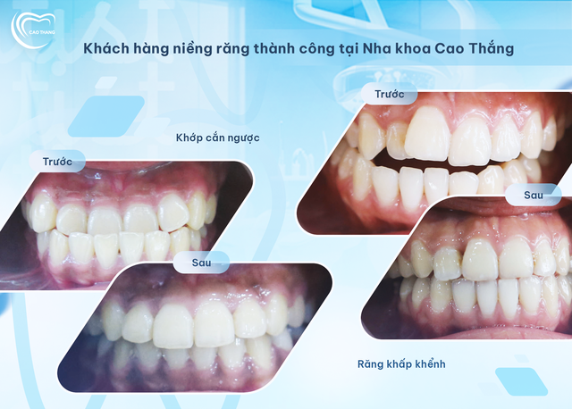 Nha khoa Cao Thắng: Chỉn chu để tốt hơn- Ảnh 3.