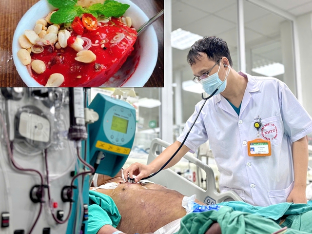 Sau 3 ngày ăn món khoái khẩu, nam thanh niên rơi vào nguy kịch- Ảnh 2.