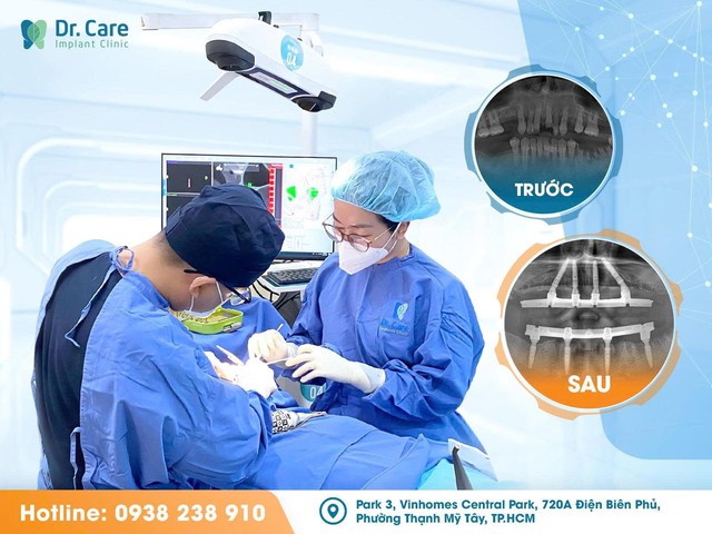 Trồng răng Implant tại Dr. Care: Công nghệ giúp khách hàng không còn sợ đau- Ảnh 2. Trồng răng Implant tại Dr. Care: Công nghệ giúp khách hàng không còn sợ đau- Ảnh 2.