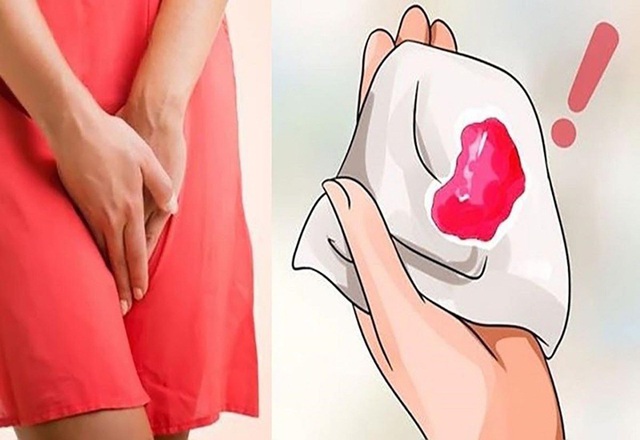 Cách tốt nhất để phát hiện sớm ung thư cổ tử cung- Ảnh 3.