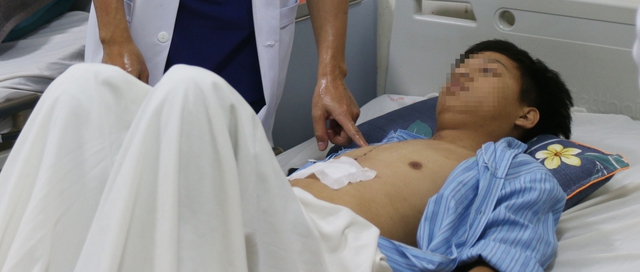 Những biến chứng sau phẫu thuật tim cần lưu ý- Ảnh 3.