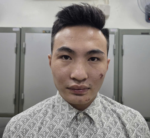 Tạm giữ thanh niên lái xe máy tông cán bộ Công an bảo vệ A80- Ảnh 1. Tạm giữ thanh niên lái xe máy tông cán bộ Công an bảo vệ A80- Ảnh 1.