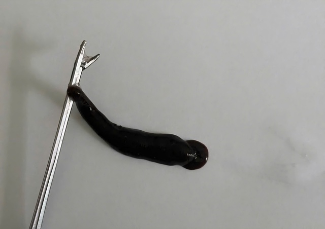 Đỉa dài 4cm ký sinh trong mũi bé trai suốt 10 ngày- Ảnh 1. Đỉa dài 4cm ký sinh trong mũi bé trai suốt 10 ngày- Ảnh 1.