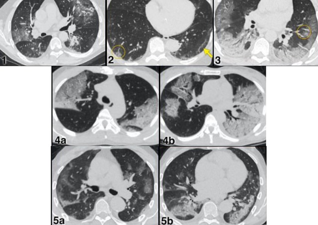 Báo động sốc nhiễm khuẩn ở trẻ- Ảnh 2.