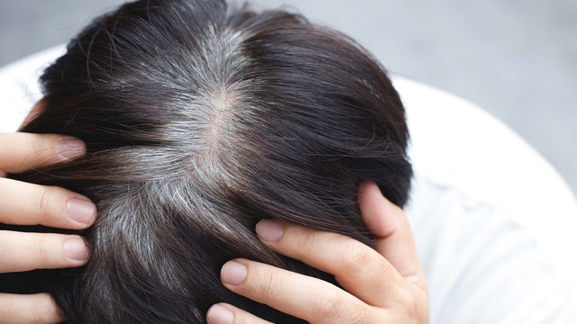Vì sao tóc bạc sớm?- Ảnh 2.
