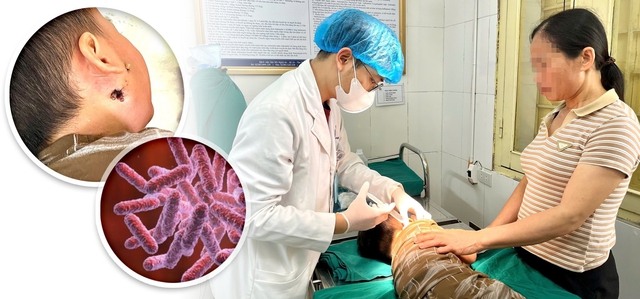 Cứu sống trẻ mắc bệnh Whitmore nguy hiểm- Ảnh 1.