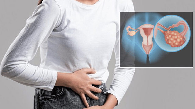 Có thể phát hiện sớm ung thư buồng trứng không?- Ảnh 1. Có thể phát hiện sớm ung thư buồng trứng không?- Ảnh 1.