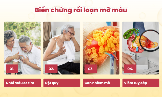 Máy đo 4 chỉ số mỡ máu PixoTest Vision - Giải pháp theo dõi sức khỏe thông minh- Ảnh 1.