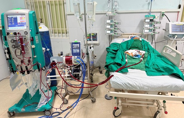 Thanh niên khỏe mạnh bất ngờ sốc tim, bác sĩ bệnh viện miền núi cứu sống bằng kỹ thuật VA-ECMO- Ảnh 1.