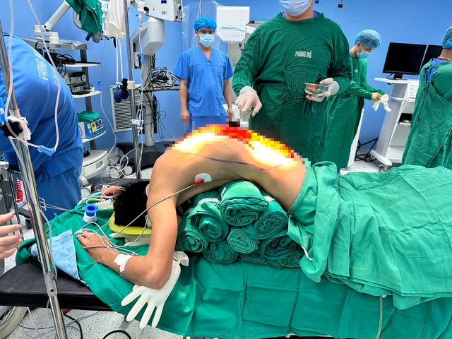 10 giờ phẫu thuật giải cứu người đàn ông 'cong như con tôm' , 7 năm cúi mặt xuống đất- Ảnh 2. 10 giờ phẫu thuật giải cứu người đàn ông 'cong như con tôm' , 7 năm cúi mặt xuống đất- Ảnh 2.