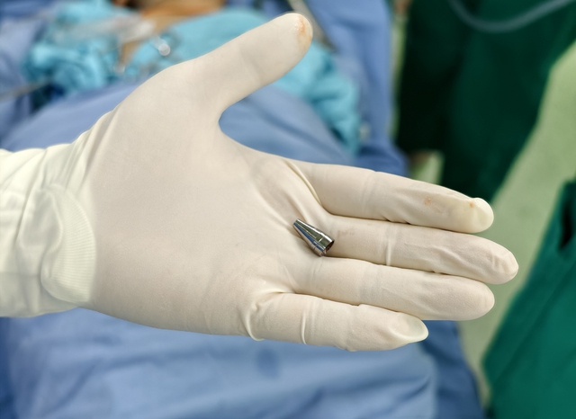  Đang ngồi học bỗng tím tái, bé trai 7 tuổi khiến bác sĩ hốt hoảng khi soi phế quản- Ảnh 2.