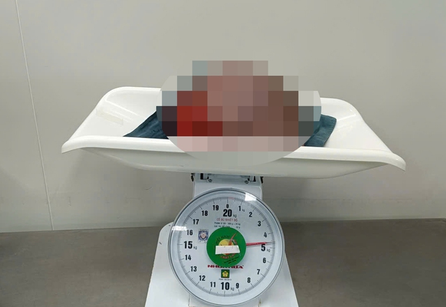 Bệnh viện tuyến tỉnh phối hợp chuyên gia nước ngoài phẫu thuật thành công bướu vú 4,5 kg- Ảnh 2.