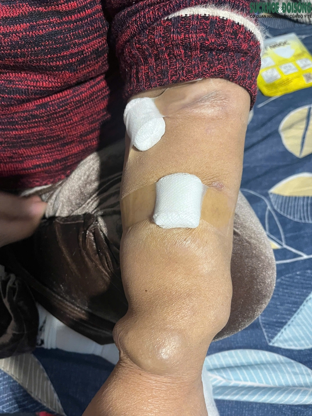 Xóm chạy thận Hà Nội co ro trong giá rét- Ảnh 5.