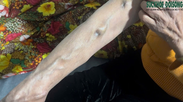 Xóm chạy thận Hà Nội co ro trong giá rét- Ảnh 7.