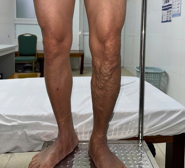 Đừng để 'đôi chân mệt mỏi' cướp mất niềm vui đón Xuân- Ảnh 1.