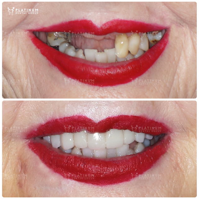 Nữ bệnh nhân người Úc tìm lại nụ cười chỉ sau 4 giờ tại Việt Nam- Ảnh 1.