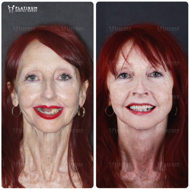 Nữ bệnh nhân người Úc tìm lại nụ cười chỉ sau 4 giờ tại Việt Nam- Ảnh 4.