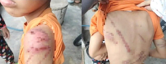 Công an điều tra vụ bé trai nghi bị cha ruột đánh- Ảnh 1.