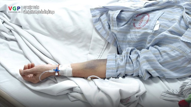 Hiểm họa sốt xuất huyết Dengue: Khi gánh nặng vượt qua những con số- Ảnh 1. Hiểm họa sốt xuất huyết Dengue: Khi gánh nặng vượt qua những con số- Ảnh 1.