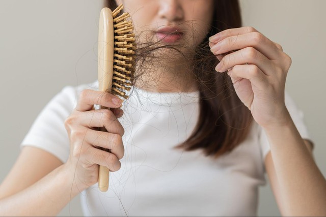 Sai lầm trong chăm sóc khiến rụng tóc nhiều người không nhận ra- Ảnh 2. Sai lầm trong chăm sóc khiến rụng tóc nhiều người không nhận ra- Ảnh 2.