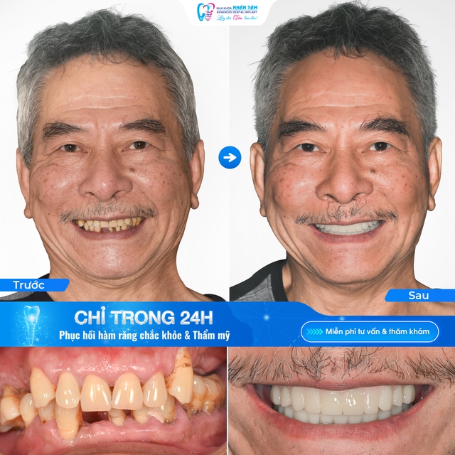 Tiến sĩ, Bác sĩ Võ Văn Nhân: Chuyên gia cấy ghép Implant với gần 30 năm kinh nghiệm- Ảnh 3.