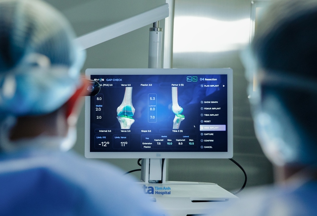 Việt Nam lần đầu có Robot AI thay khớp thế hệ mới, tăng cao hiệu quả và an toàn- Ảnh 2. Việt Nam lần đầu có Robot AI thay khớp thế hệ mới, tăng cao hiệu quả và an toàn- Ảnh 2.