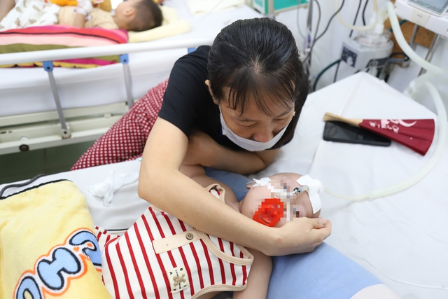 Bệnh tay chân miệng tăng cao ở TPHCM, nhiều ca nặng do chủng EV71- Ảnh 2.