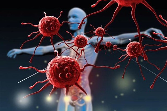 Ung thư có thể xuất hiện ở bất kỳ cơ quan nào trong cơ thể, nhưng một số bộ phận có nguy cơ cao hơn