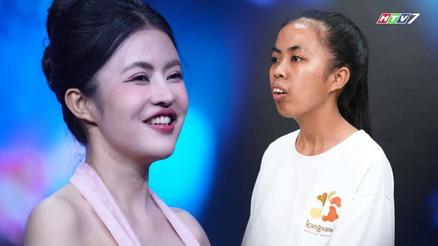 300 giờ phẫu thuật, 120 ngày thay đổi diện mạo: Vì sao chỉnh hàm chưa phải 'điểm kết'?- Ảnh 1.