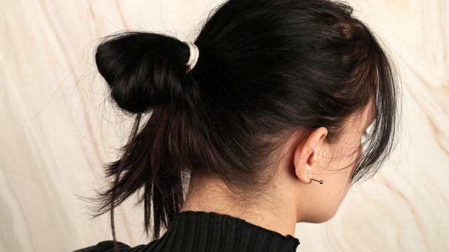 Tại sao tóc rụng nhiều? - Ảnh 2.