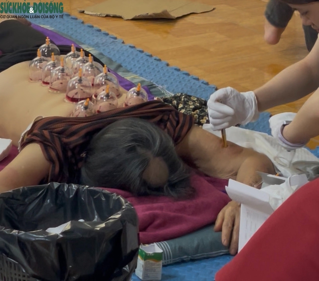 Mục sở thị cơ sở chữa bách bệnh bằng... 'giác hơi hút máu' ở Hà Nội- Ảnh 10.