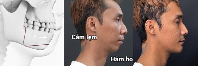 Fan ruột Sơn Tùng M-TP 'lột xác' để theo đuổi visual nghệ sĩ- Ảnh 2. Fan ruột Sơn Tùng M-TP 'lột xác' để theo đuổi visual nghệ sĩ- Ảnh 2.