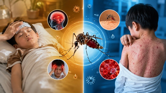 Đừng xem nhẹ những cơn sốt mùa hè- Ảnh 1. Đừng xem nhẹ những cơn sốt mùa hè- Ảnh 1.