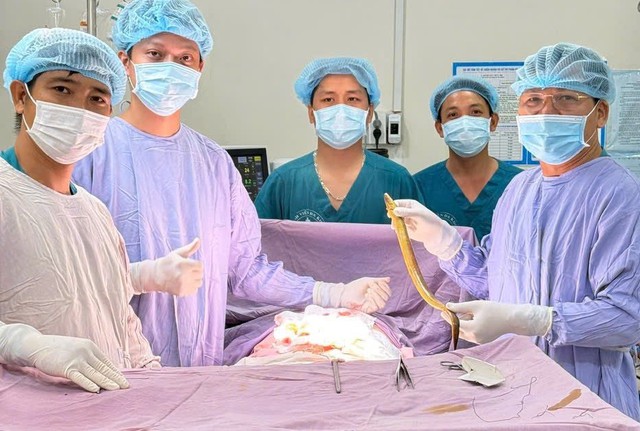 Đau bụng dữ dội, bác sĩ phát hiện con lươn dài hơn 50cm trong
ổ bụng người đàn ông- Ảnh 1.