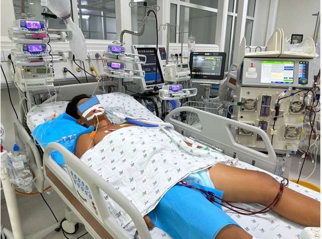 Đá bóng dưới trời nắng, bé trai sốc nhiệt biến chứng huỷ cơ, suy đa cơ quan- Ảnh 1.